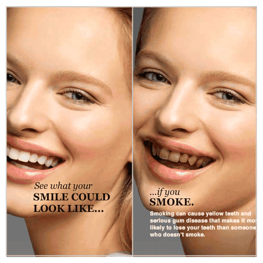 Yellow teeth and gum disease caused by smoking as illustrated in the FDA's "The Real Cost Campaign."