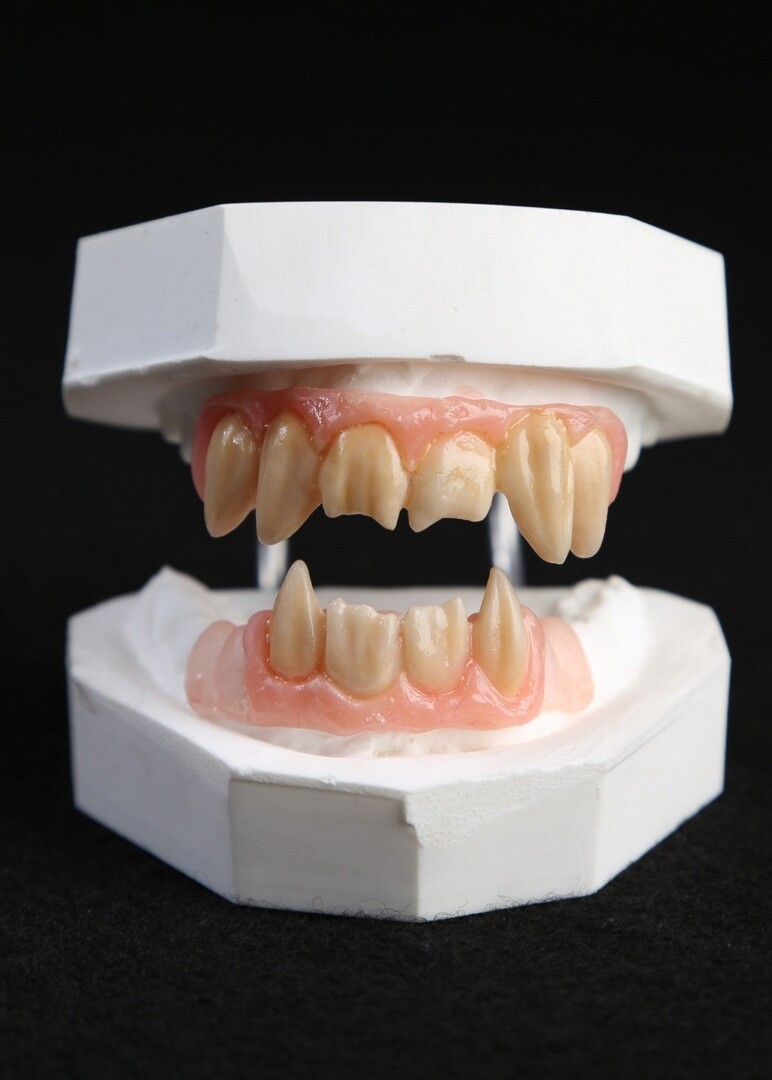 A third model of sharp, inhuman 3D printed teeth.