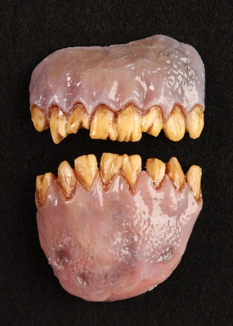A fifth model of rotted, inhuman 3D printed teeth.