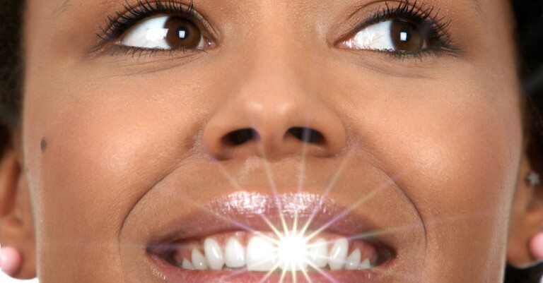 Woman with sparkling white teeth