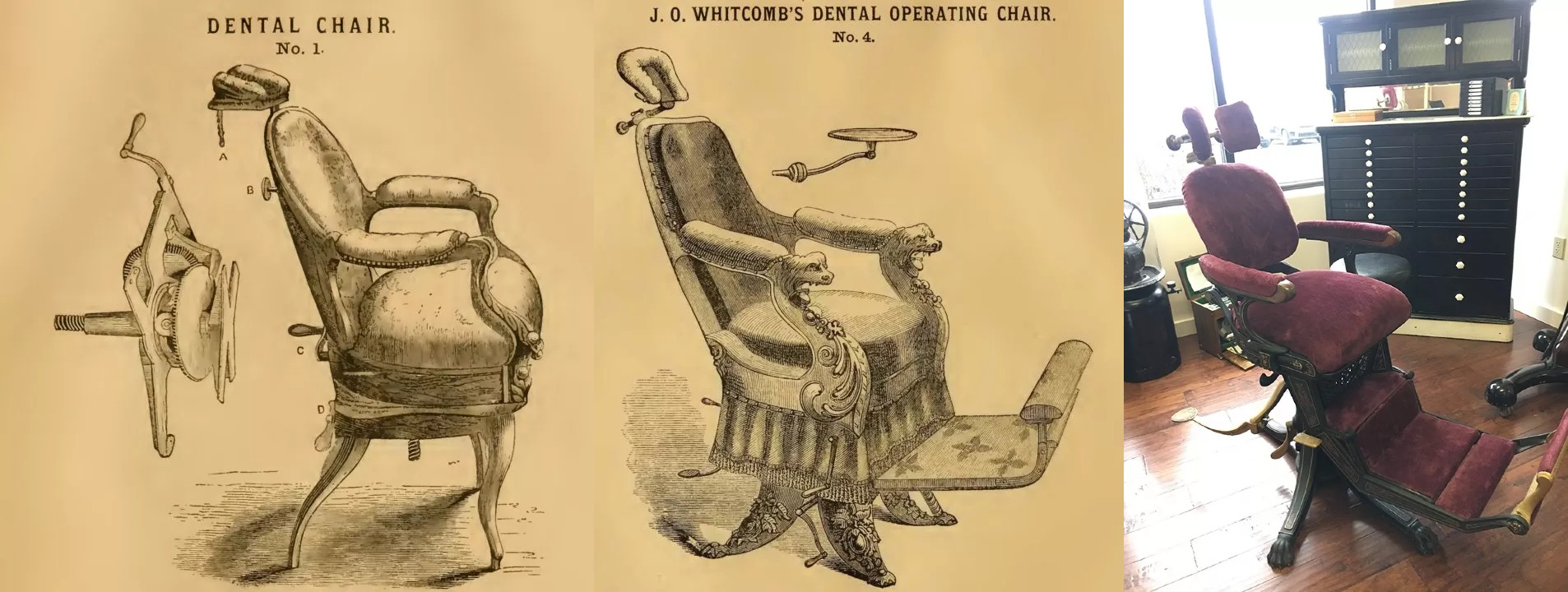 Images of historical dental chairs: two illustrations and one photograph.