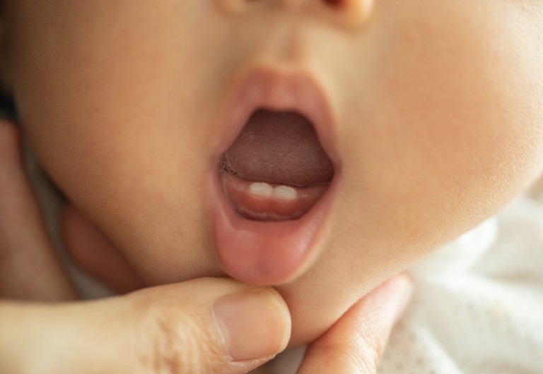 Is there a link between baby teeth and mental health issues?