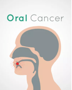 An illustrated cross-section of the human head featuring a red icon in the mouth area. Text at the top of the image reads "Oral Cancer."