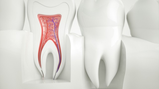 root canal treatment Benco