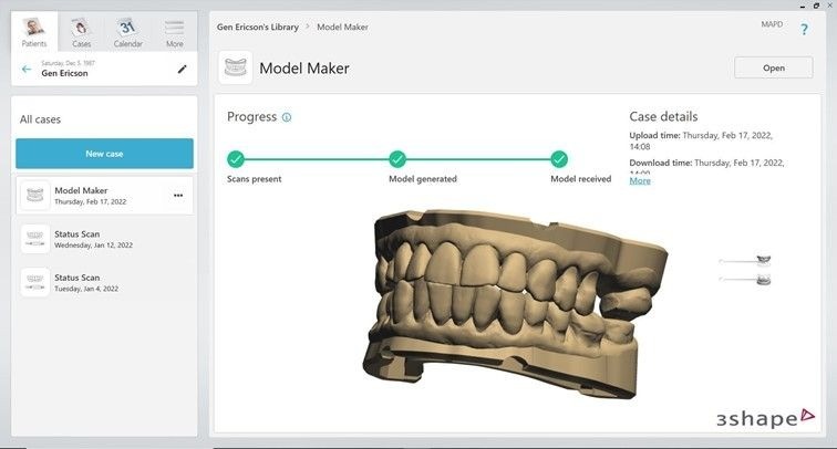 A screenshot of 3Shape's automate software in action, depicting a 3D model of dentures.