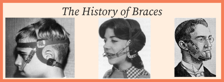 A banner image titled "A History of Braces" that shows three images of people with antique headgear braces: left, a young boy; middle, a young girl; right, an adult man with glasses.